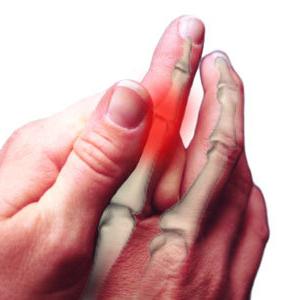 โรคข้ออักเสบของนิ้วมือ: การรักษาสาเหตุอาการ